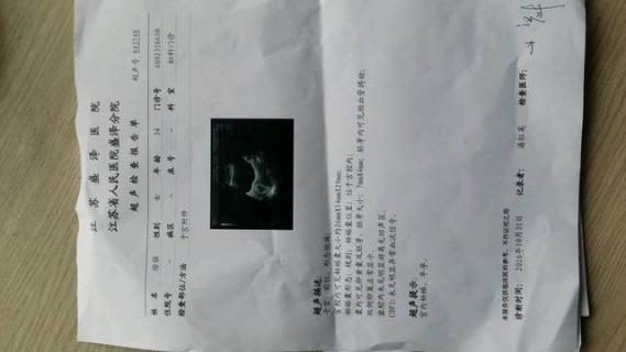 檢查輸卵管是否堵塞做什么檢查最好(檢查輸卵管是否堵塞做什么檢查)