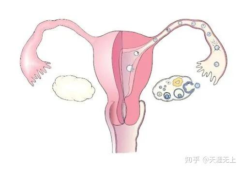 輸卵管堵塞手術(shù)費(fèi)用大概要多少(輸卵管堵塞有什么辦法可以懷孕)