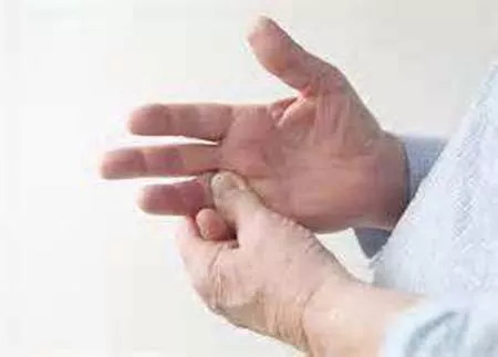 風濕早期10個征兆纖維是風濕不(風濕早期10個征兆)