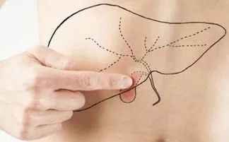 肝不好的人有哪些癥狀(肝不好的表現(xiàn)有哪些癥狀)