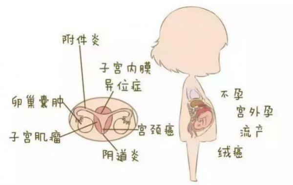 宮外孕不能生育嗎(宮外孕的女人不能要了)