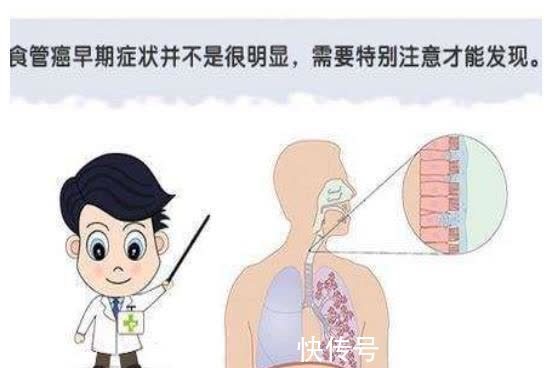 喉嚨發癢要警惕四種病出現這種壯吃什么藥好(喉嚨發癢要警惕四種病)