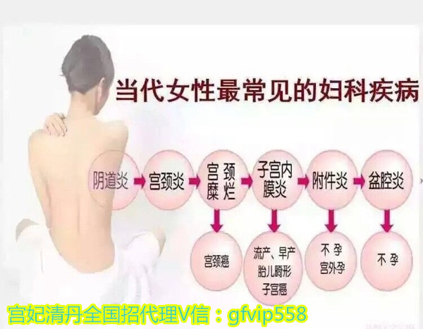 15種常見的婦科疾病手術(15種常見的婦科疾病)