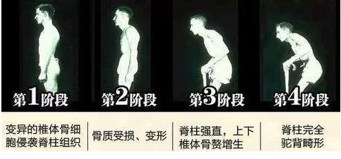 男性性疾病初期癥狀腿部(男性性疾病初期癥狀)