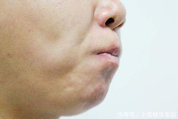 吃維生素b2多久乳房會變大(下邊干澀吃維生素b2管用嗎)