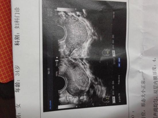 盆腔炎做b超能看出來嗎（附件炎做b超能查出來嗎）