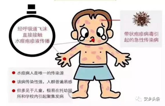 女人得性疾病初期什么癥狀（被傳染性疾病多久會有癥狀）