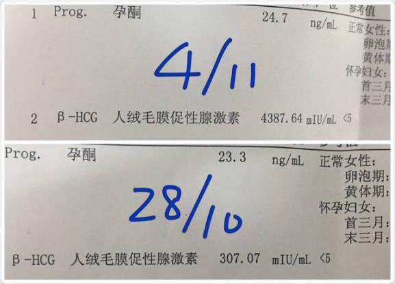 一般懷孕多少天可以查出來B超(一般懷孕多少天可以查出來)