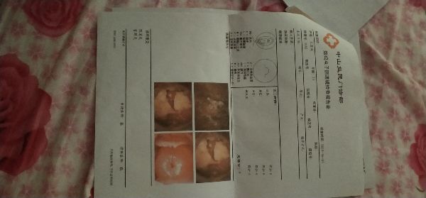婦科衣原體是什么病(婦科支原體是什么病)