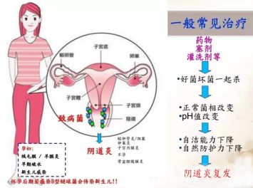婦科炎癥癥狀對照表（婦科炎癥常見癥狀）