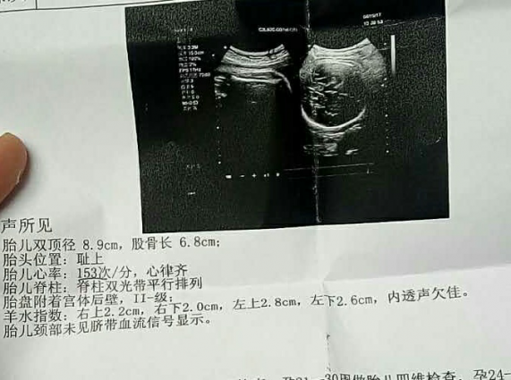 輸卵管造影多少錢大概多少錢(輸卵管造影多少錢大概多少錢二甲)