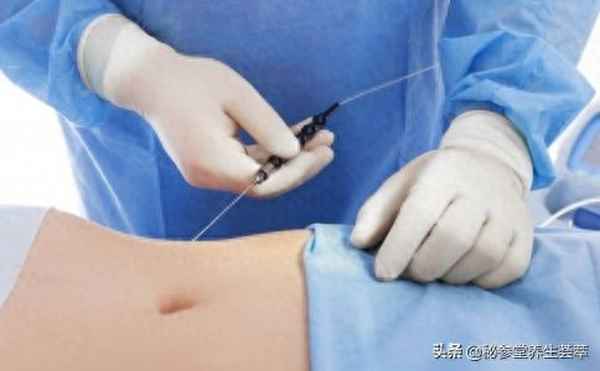 瘦身針多少錢一針(瘦身針多少錢一針有什么副作用)
