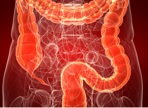 早期腸癌能活多久(早期腸癌能100%治愈嗎)