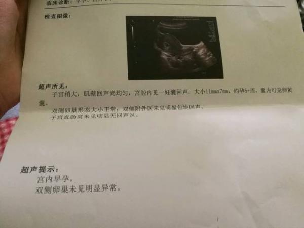 宮外孕最早幾天會流血(宮外孕最早幾天會流血出多久的血)