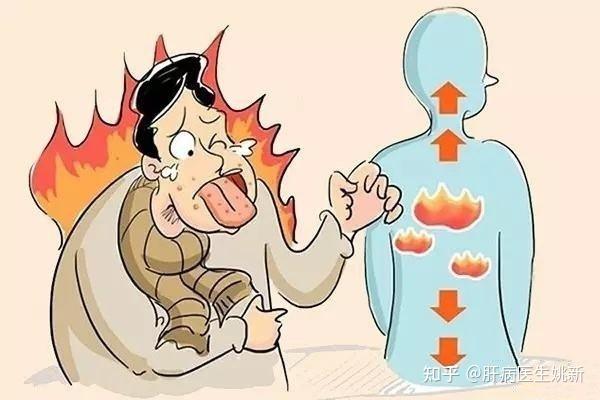 肝火旺的癥狀有哪些表現(肝火旺的癥狀有哪些表現男性)