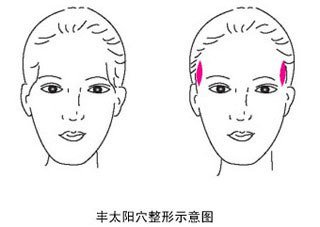 打玻尿酸的好處和壞處(打玻尿酸好處與危害)