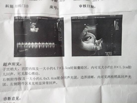 懷孕千萬不要太早做b超(確認(rèn)懷孕做b超需要空腹嗎)