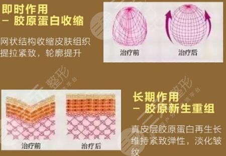 膠原蛋白副作用和危害(膠原蛋白的主要功效和副作用)