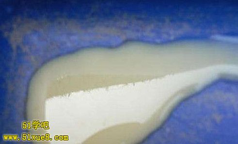 尿液有白色渾濁物是怎么回事(尿液有白色渾濁物是怎么回事女性)