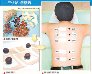 三伏貼多少錢一盒(三伏貼多少錢一盒圖片)