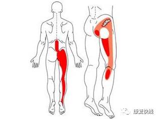 坐骨神經痛的癥狀和治療方法(腰部坐骨神經痛的癥狀和治療方法)
