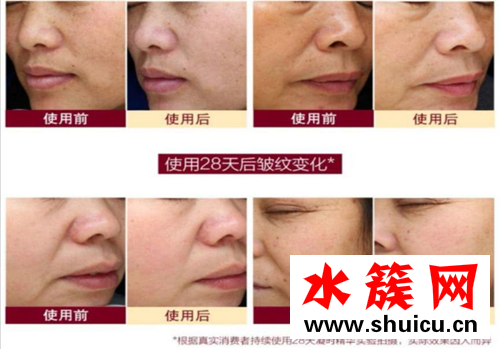 2019美伊大賞抗初老人氣精華： 片仔癀“小彈簧” 4周塑造澎彈“初本肌”