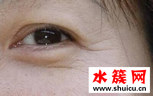 眼部皺紋用什么眼霜好 好用到哭泣的去皺眼霜 眼部皺紋用什么眼霜好 好用到哭泣的去皺眼霜