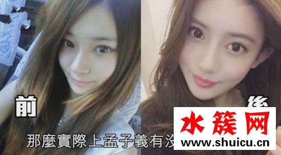 孟子義整容前后照片