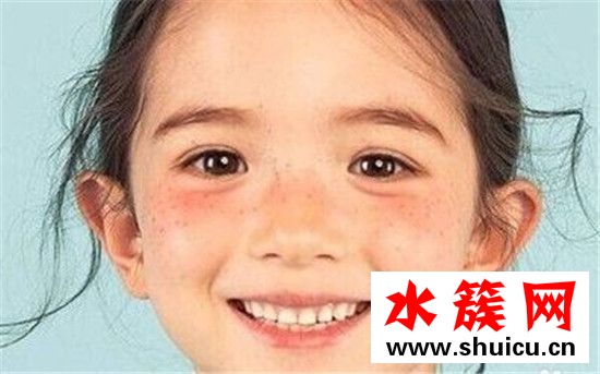 夏天曬斑怎么去除 夏天曬斑到冬天會(huì)沒嗎 夏天曬斑怎么去除 夏天曬斑到冬天會(huì)沒嗎