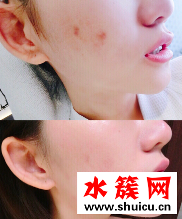 換季時刻：你有一份安瓶怎么使用方法待查收