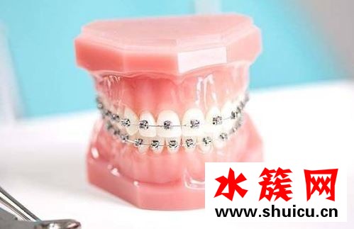 懷孕了可以整牙嗎